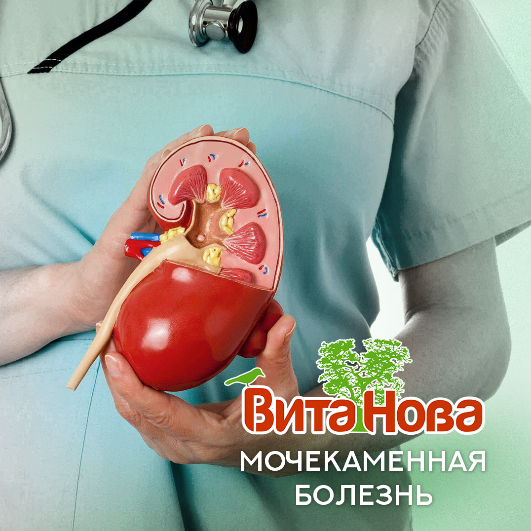 Мочекаменная болезнь - ВитаНова